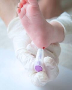 JAUNDICE TEST