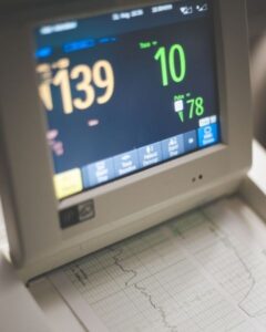 ECG